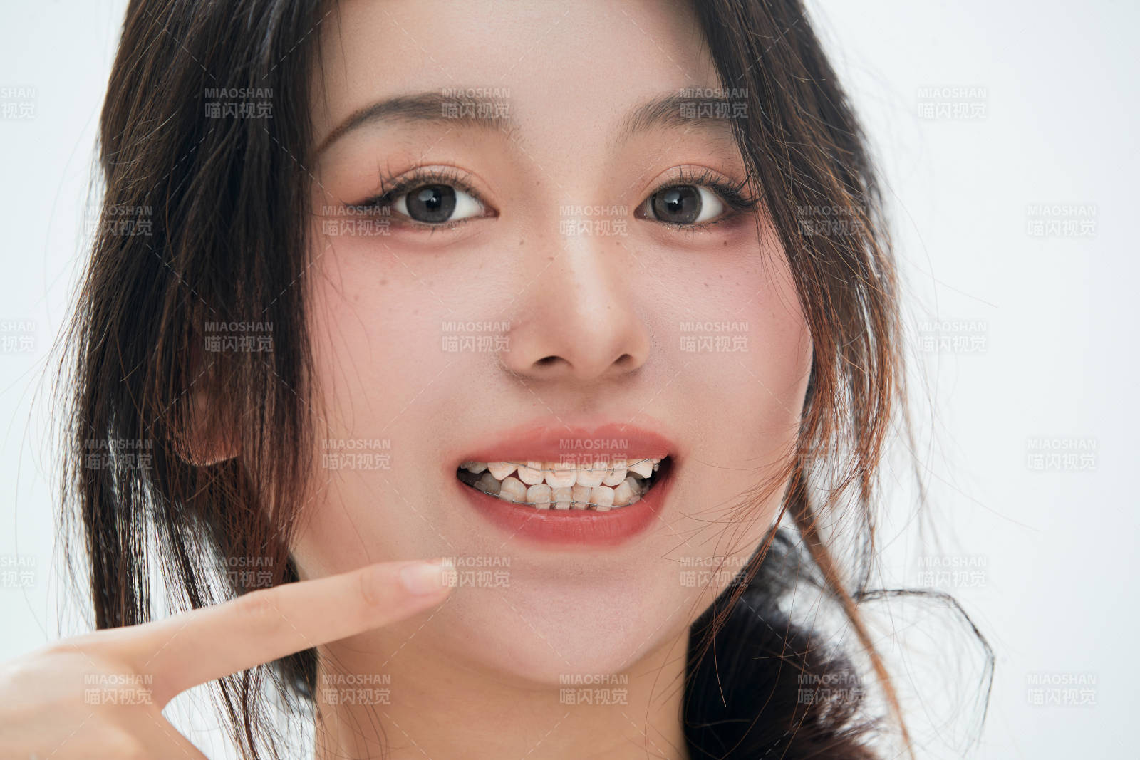 佩戴牙齿矫正器的亚洲美女牙齿矫正牙科图片