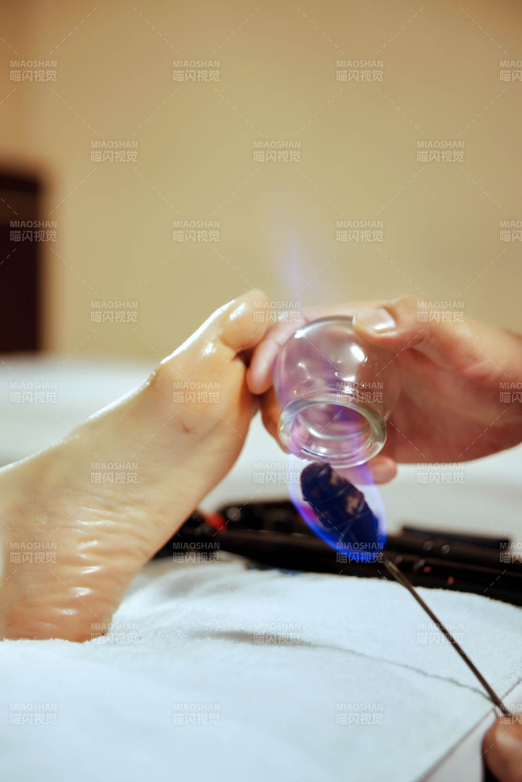 专业的足疗技师为顾客做足底火罐图片