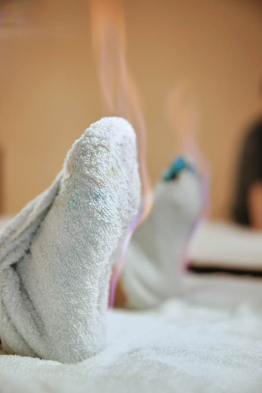 专业的足疗技师为顾客做足底火罐图片