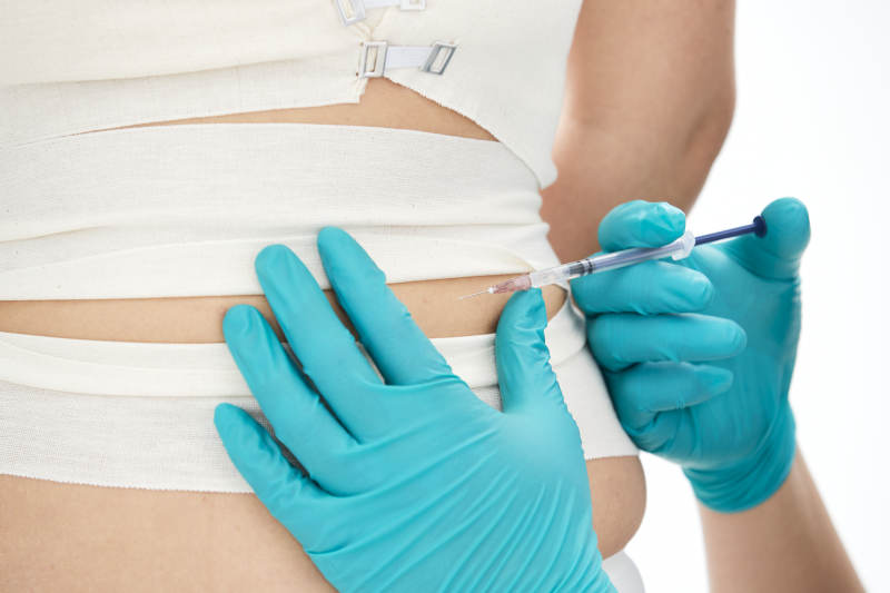 医疗美容身体整形注射及检查图片