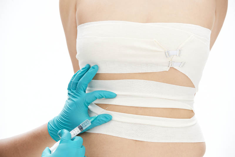 医疗美容身体整形注射及检查图片