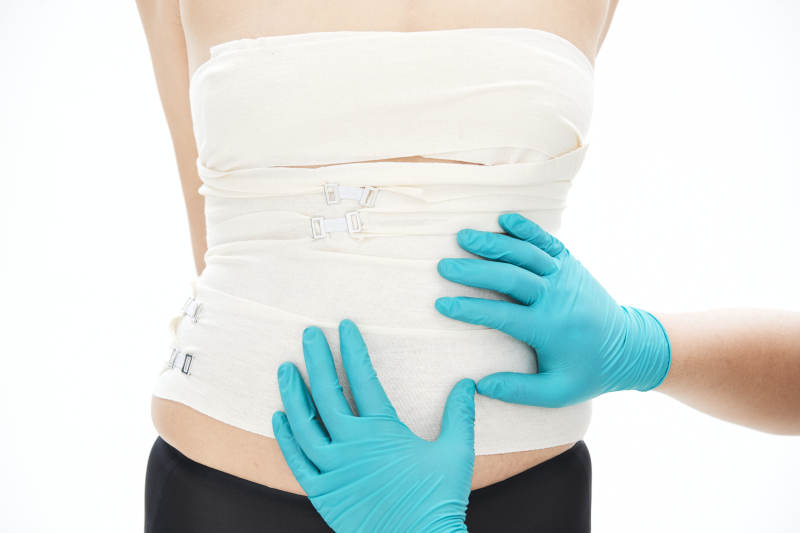 医疗美容型体整形术后检查图片