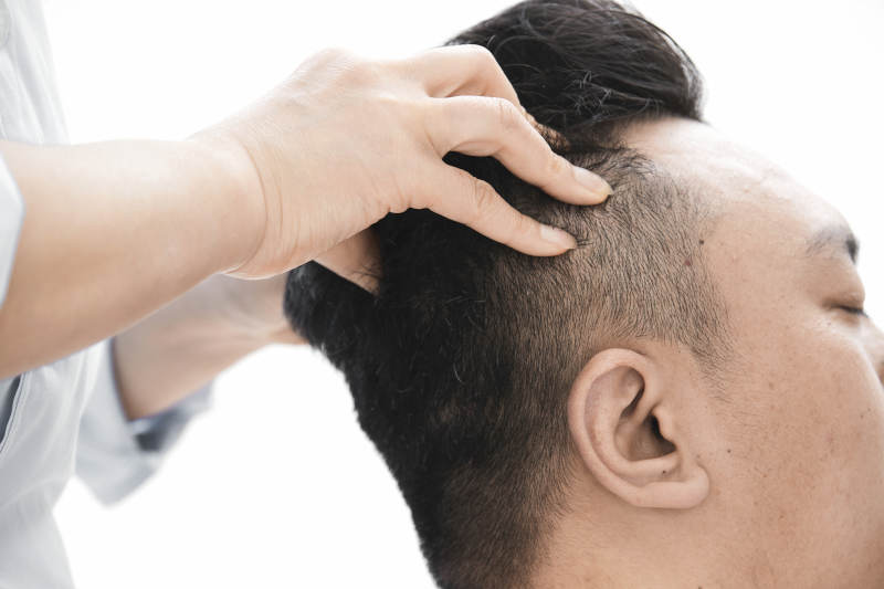 专业按摩师为男子进行头部按摩图片