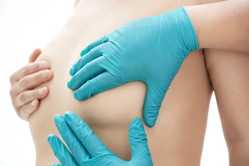 医生为胸部整形患者进行胸部检查图片