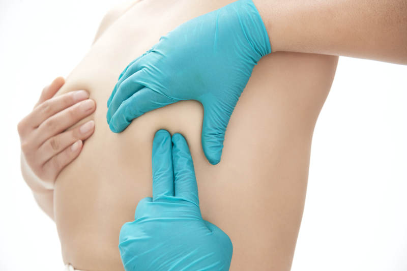 医生为胸部整形患者进行胸部检查图片