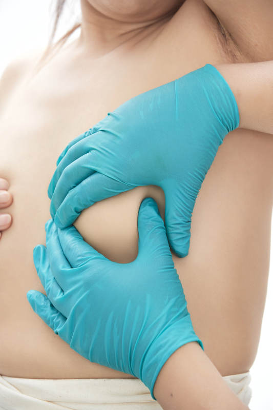 医学美容身体整形手术前躯干上的蚂蚁线图片