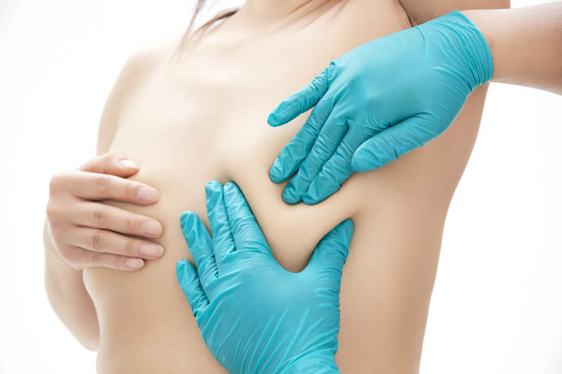 医生为胸部整形患者进行胸部检查图片