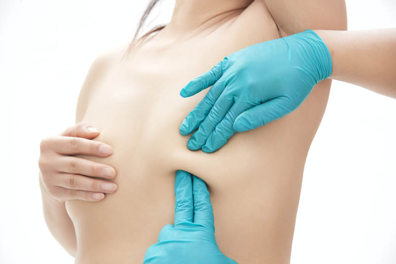 医生为胸部整形患者进行胸部检查 图片