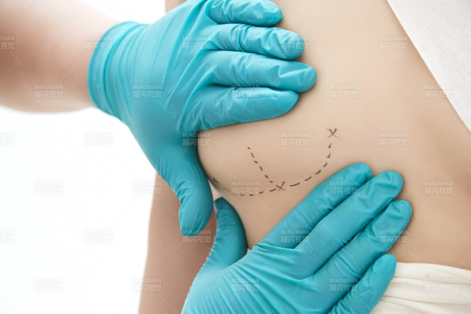 医生为胸部整形患者进行胸部检查图片