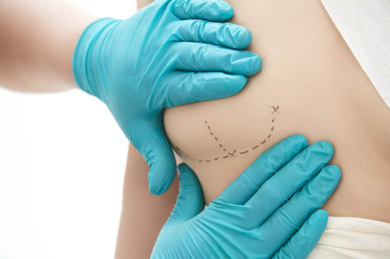 医生为胸部整形患者进行胸部检查图片