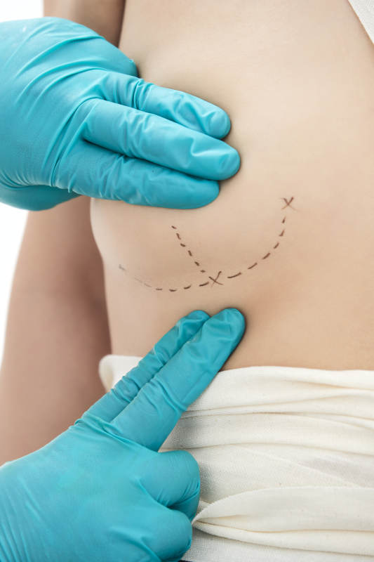 医生为胸部整形患者进行胸部检查图片