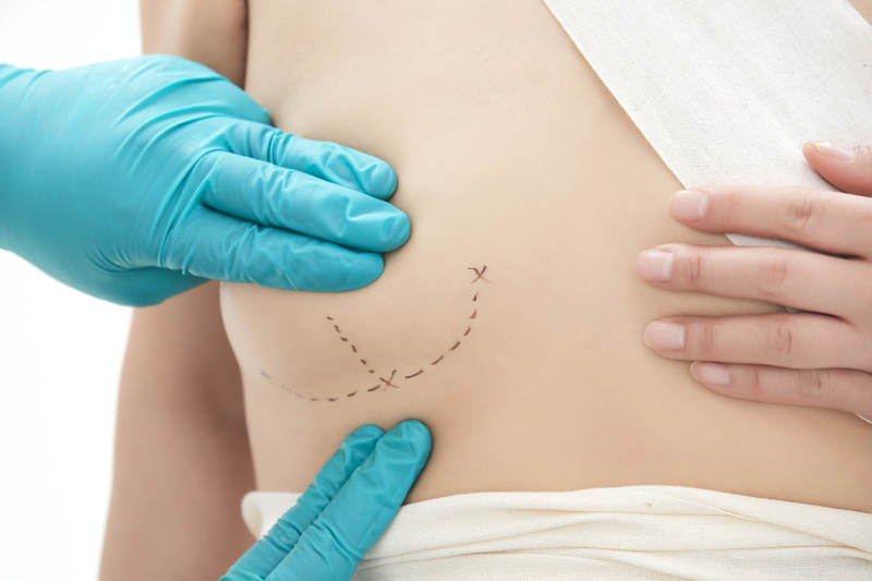 医生为胸部整形患者进行胸部检查图片