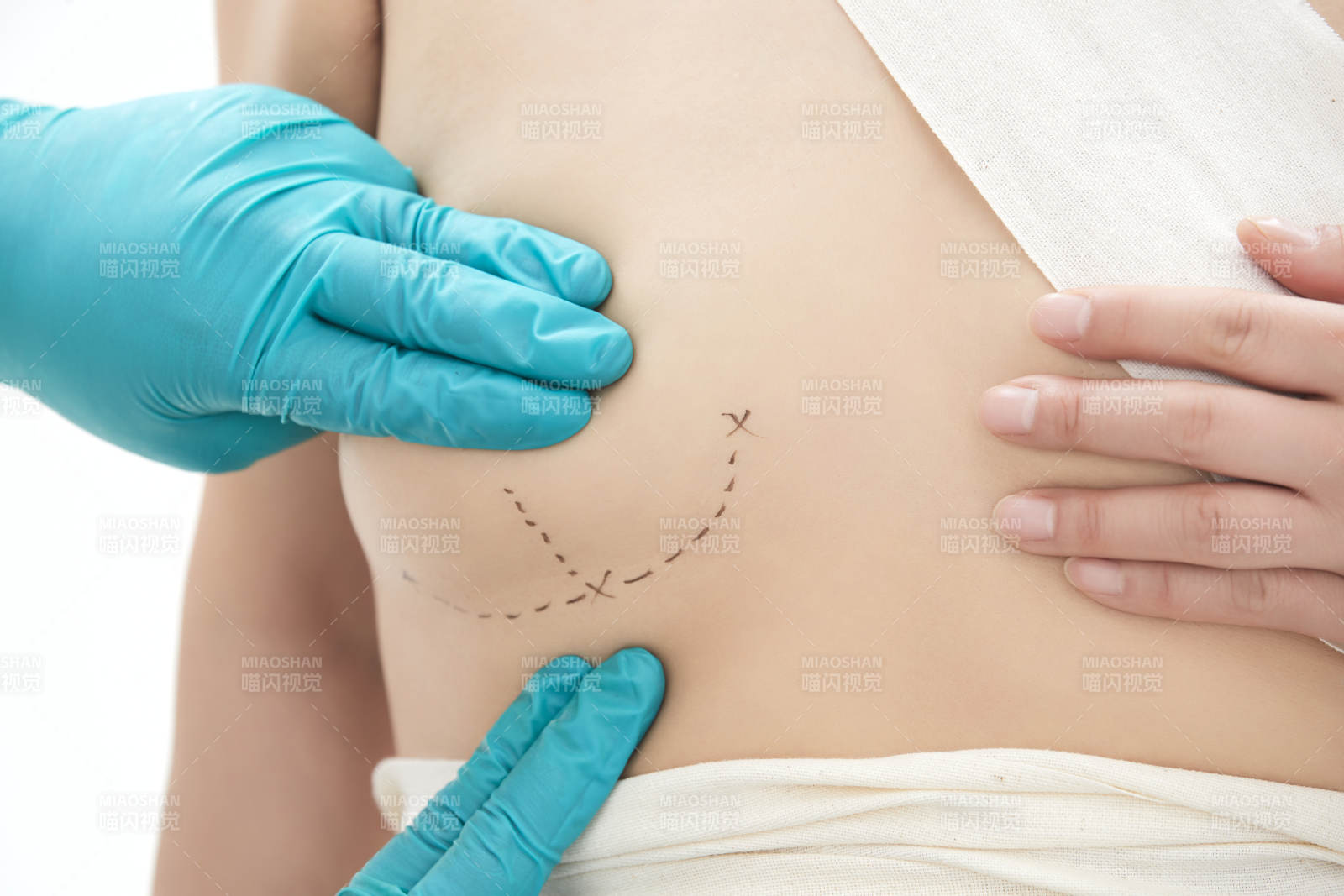 医生为胸部整形患者进行胸部检查图片