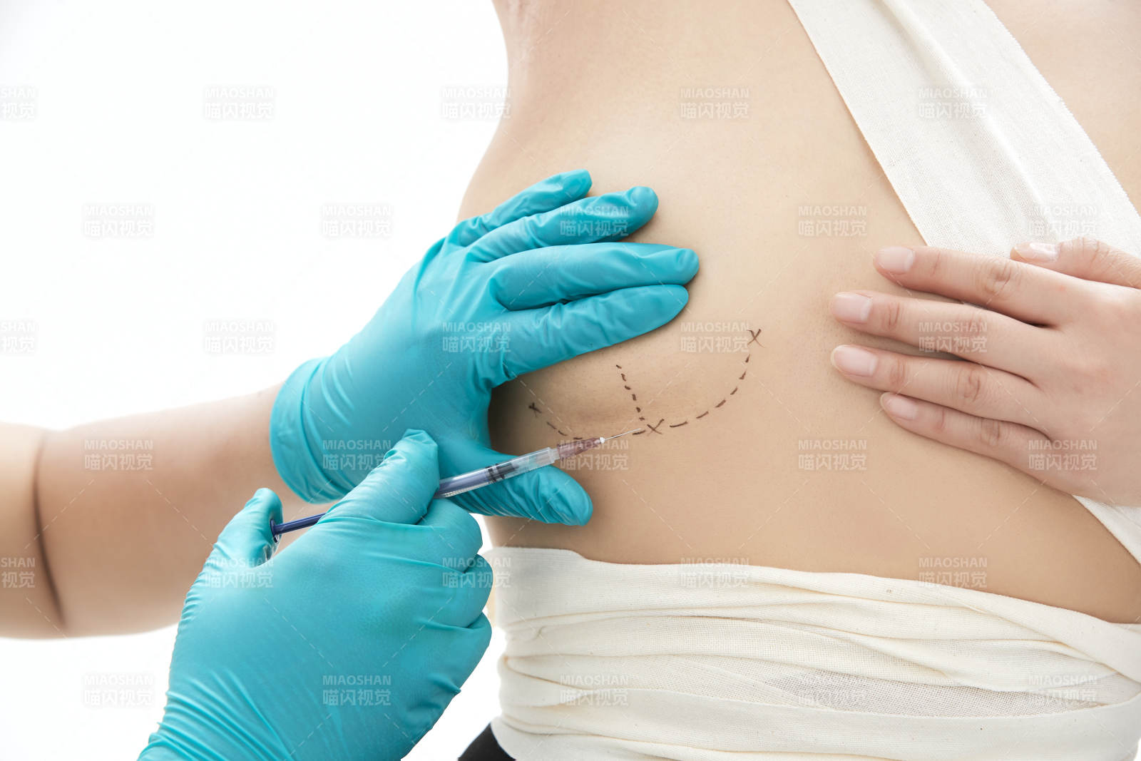 医生为胸部整形患者进行胸部检查图片