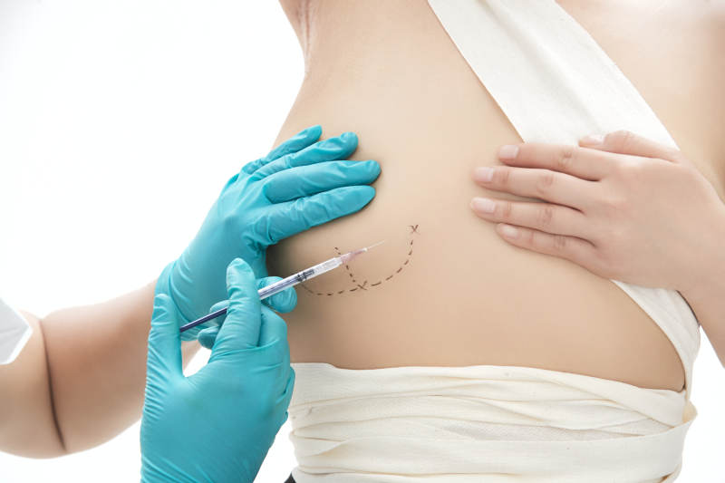 医生为胸部整形患者进行胸部检查图片