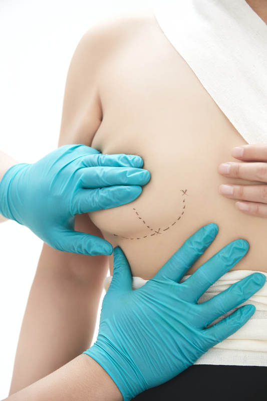 医生为胸部整形患者进行胸部检查图片