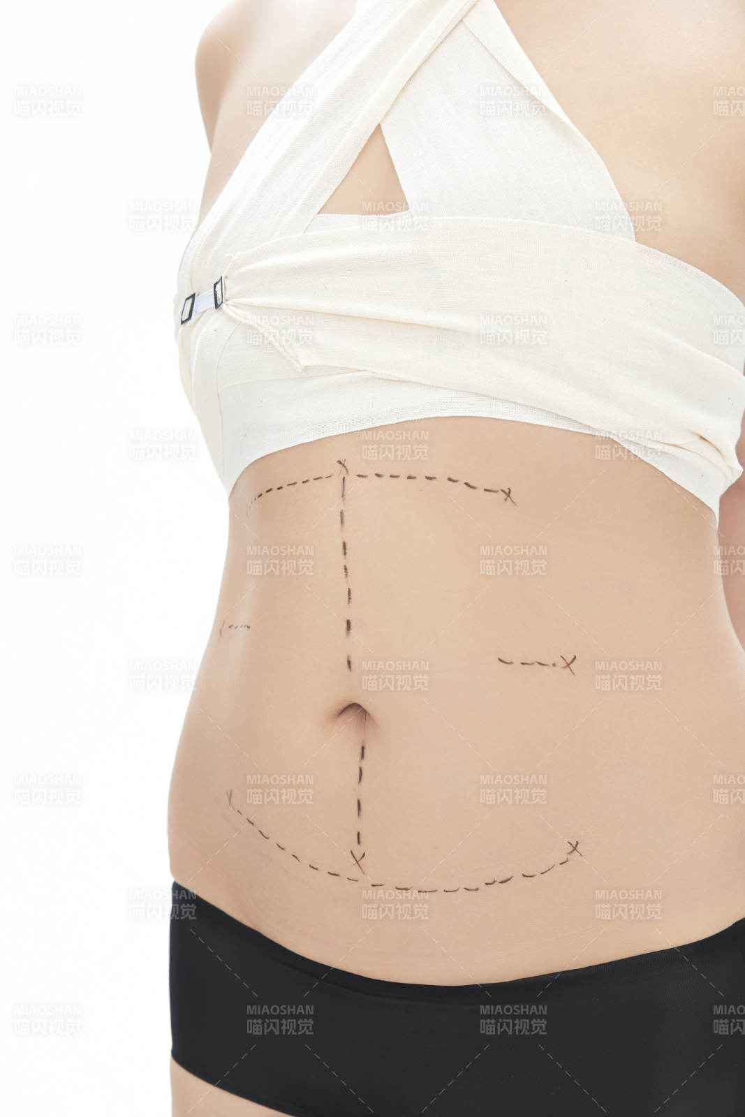 医学美容身体整形手术前躯干上的蚂蚁线图片