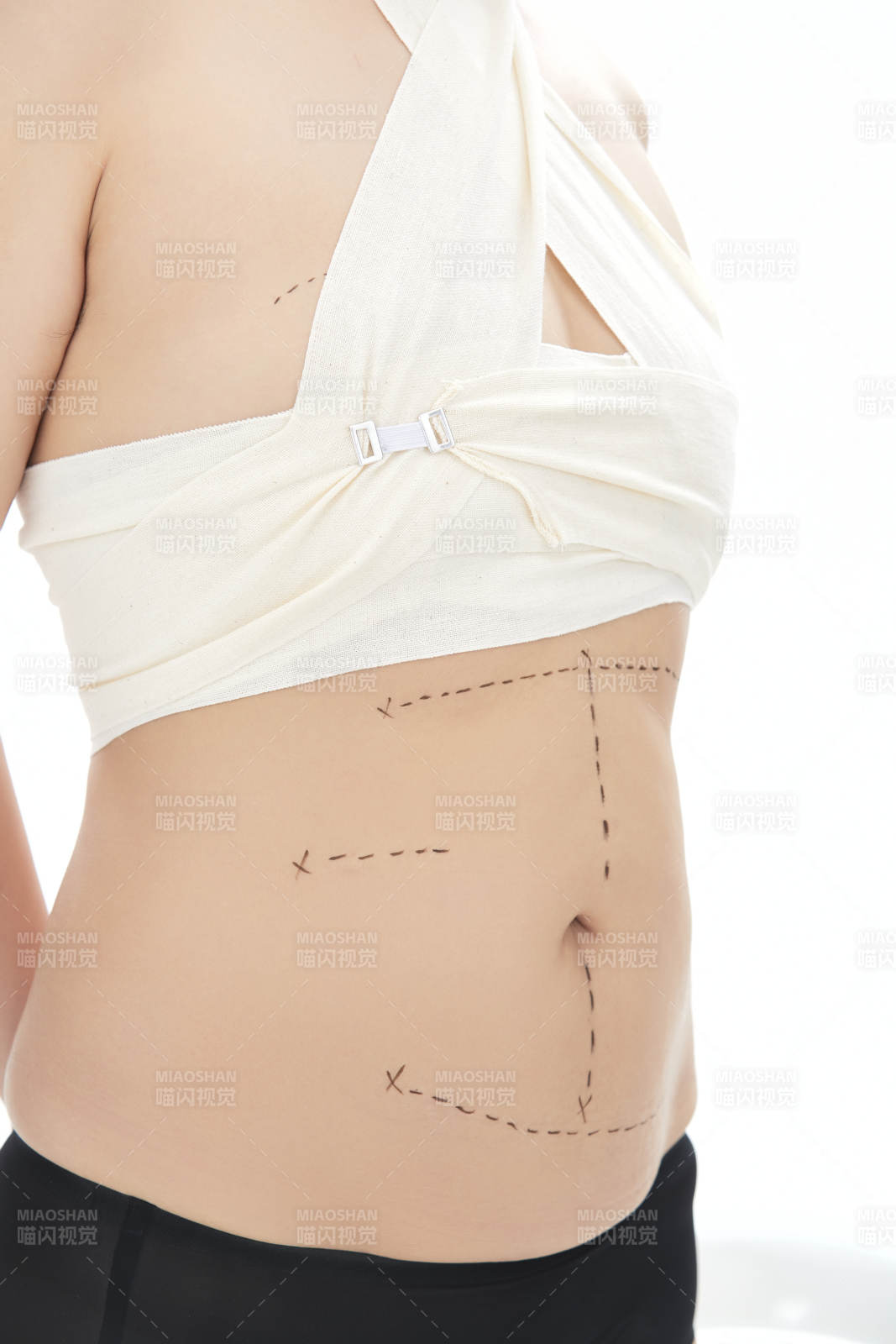 医学美容身体整形手术前躯干上的蚂蚁线图片