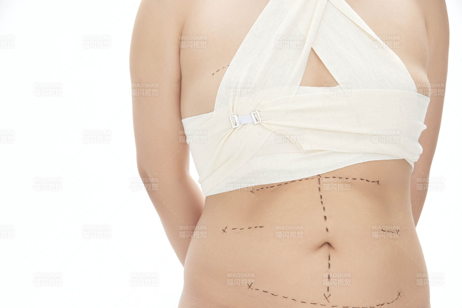 医学美容身体整形手术前躯干上的蚂蚁线图片