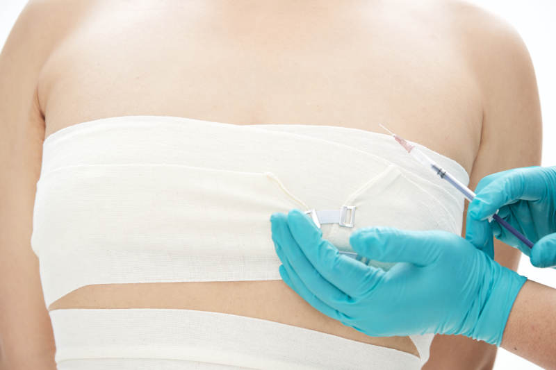 医疗美容身体整形注射及检查图片