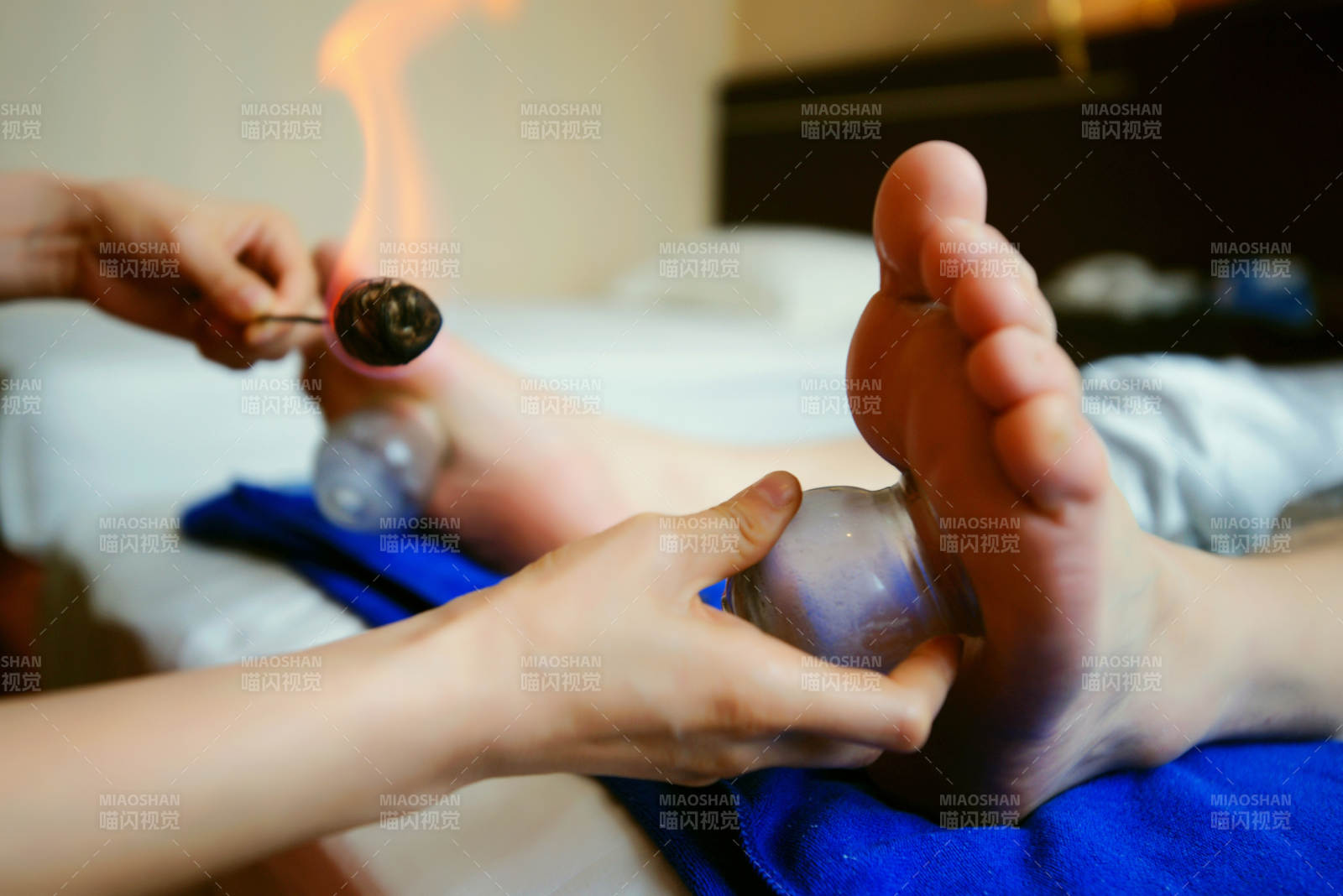 专业的足疗技师为顾客做足底火罐图片