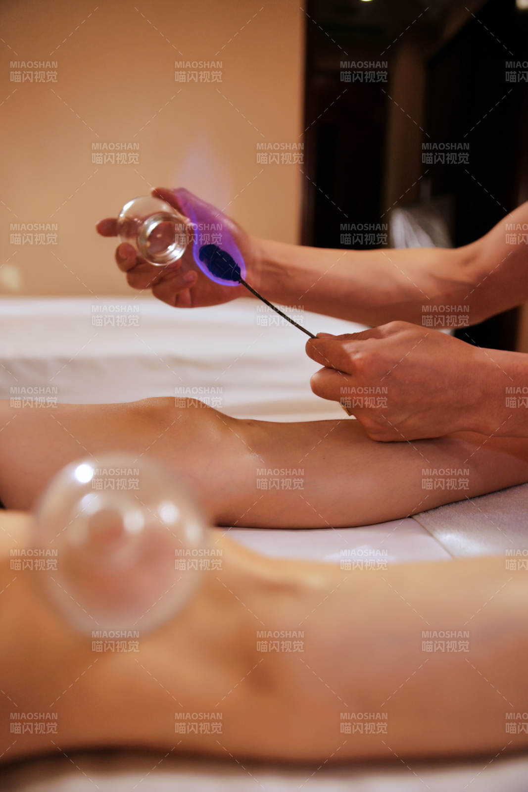 专业的保健技师为顾客进行吸筒疗法拔火罐图片