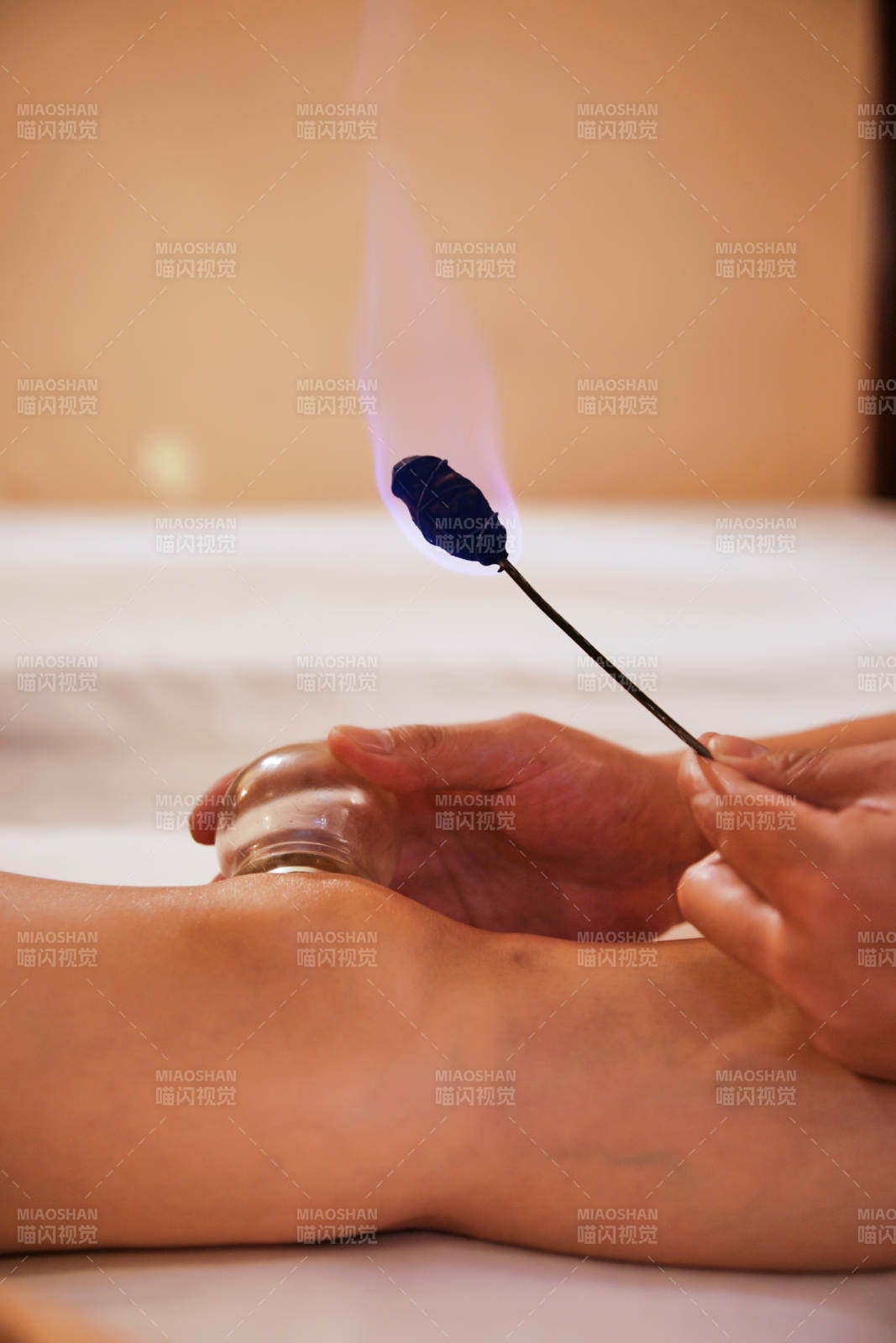专业的保健技师为顾客进行吸筒疗法拔火罐图片