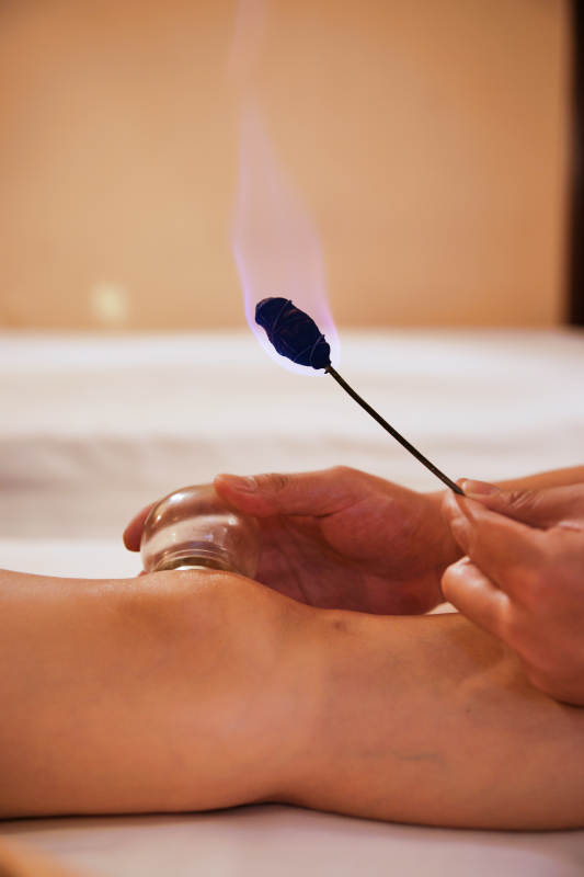 专业的保健技师为顾客进行吸筒疗法拔火罐图片