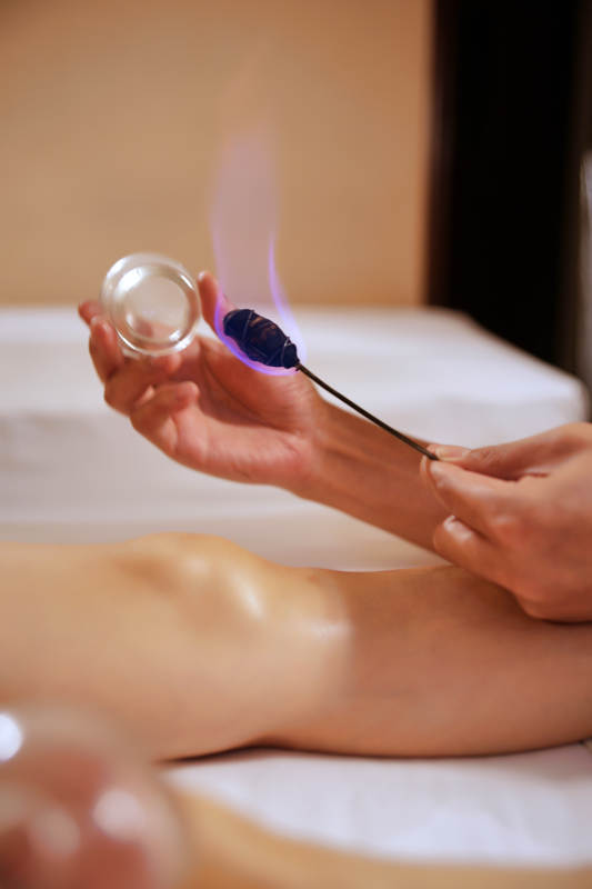 专业的保健技师为顾客进行吸筒疗法拔火罐图片