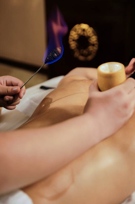 专业的保健技师为顾客进行吸筒疗法拔火罐图片