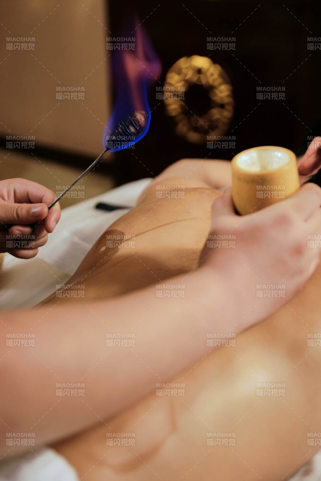 专业的保健技师为顾客进行吸筒疗法拔火罐图片