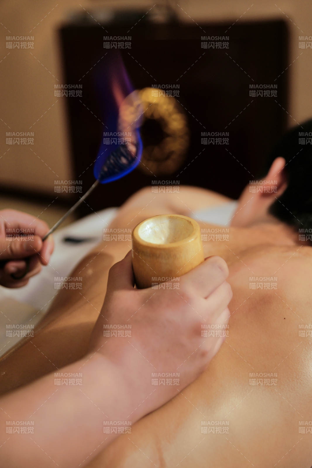 专业的保健技师为顾客进行吸筒疗法拔火罐图片