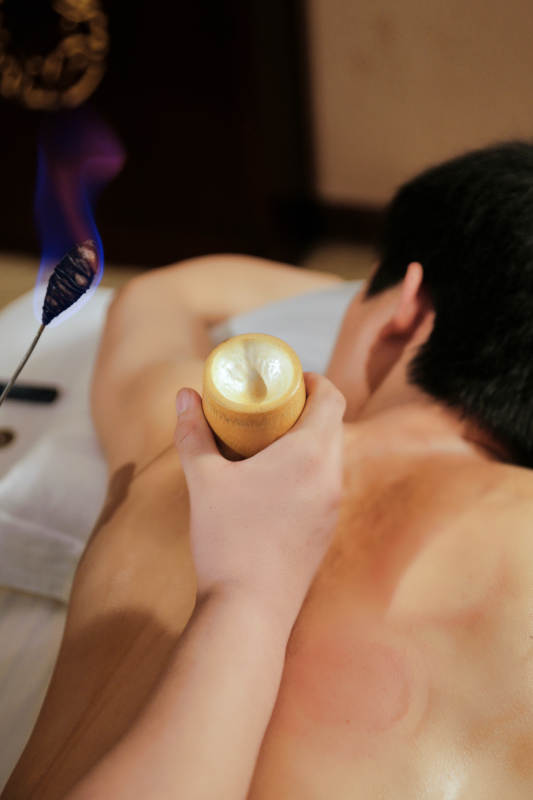 专业的保健技师为顾客进行吸筒疗法拔火罐图片