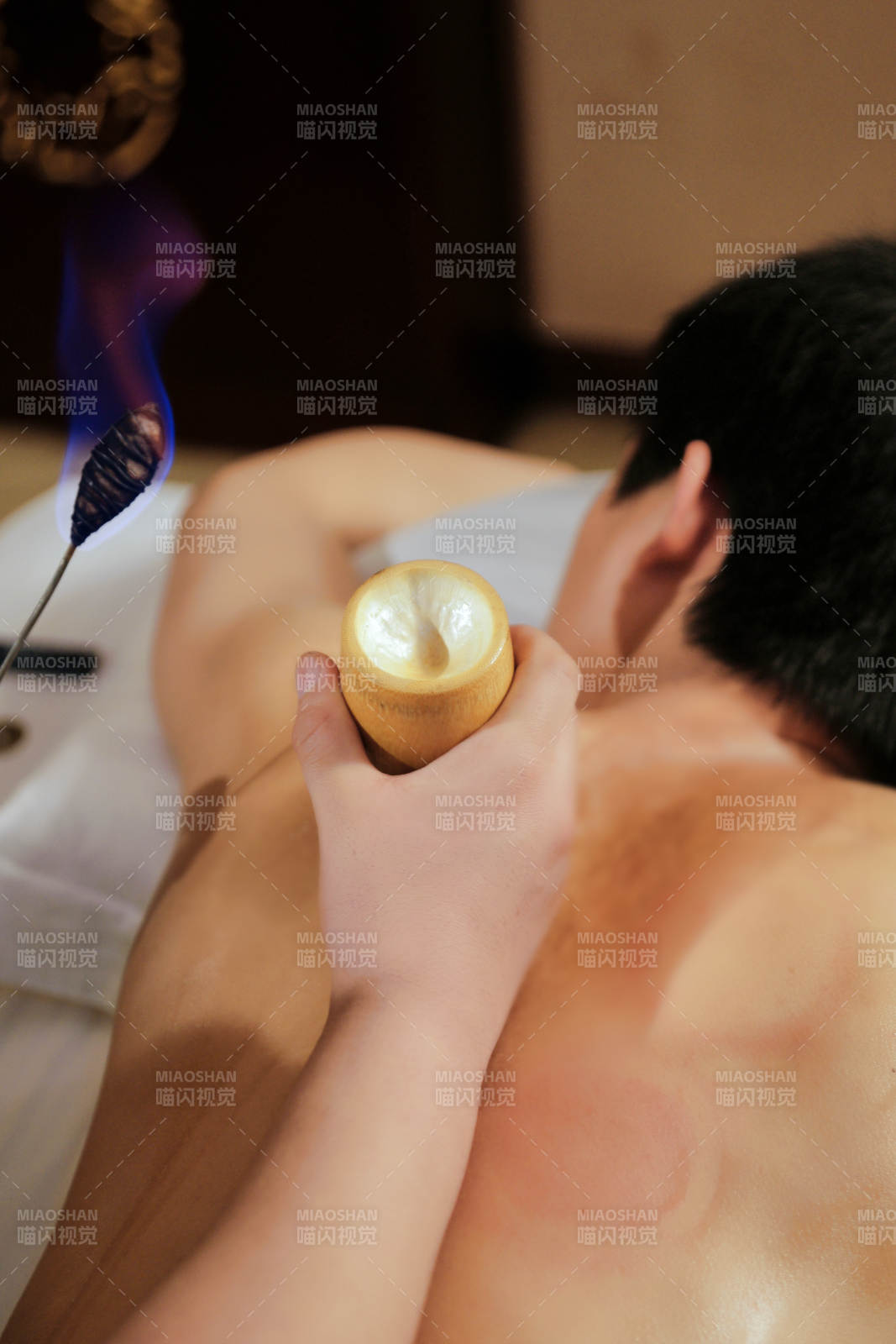 专业的保健技师为顾客进行吸筒疗法拔火罐图片