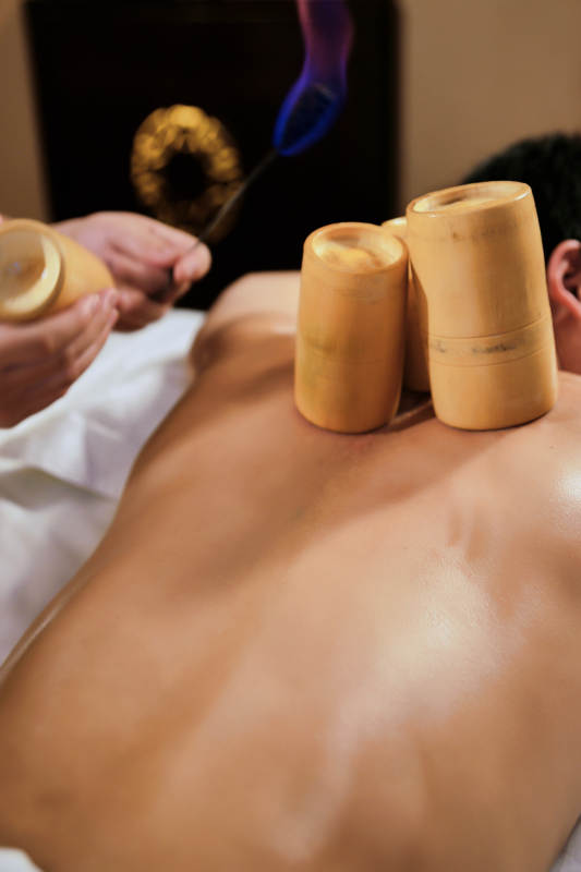 专业的保健技师为顾客进行吸筒疗法拔火罐图片