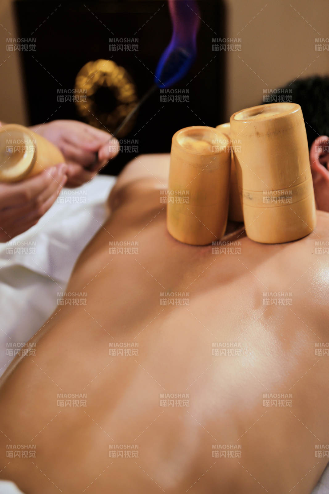 专业的保健技师为顾客进行吸筒疗法拔火罐图片