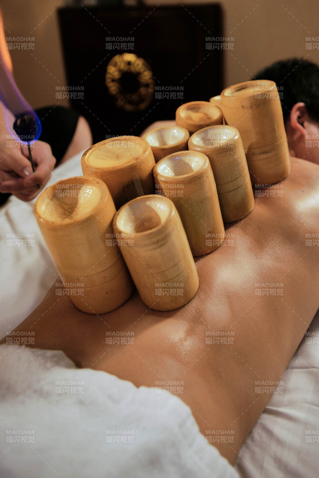 专业的保健技师为顾客进行吸筒疗法拔火罐图片