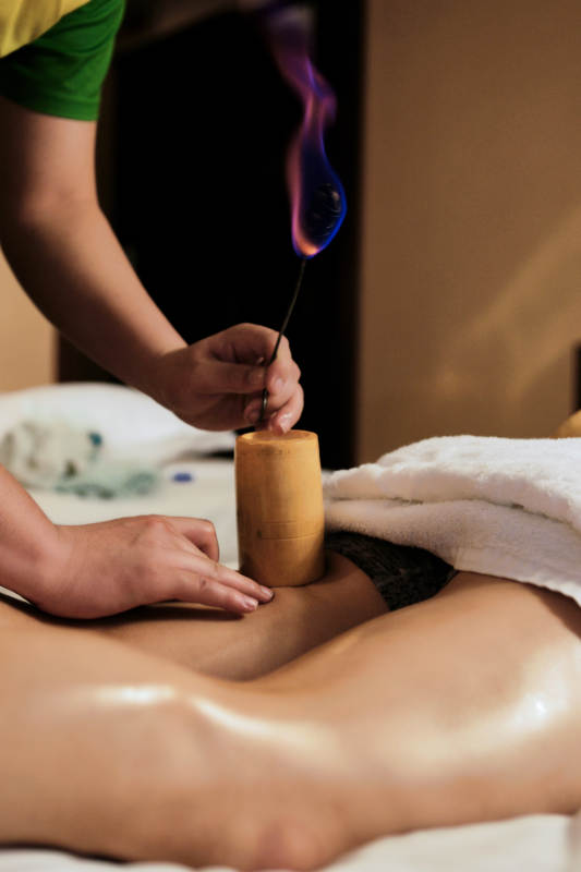 专业的保健技师为顾客进行吸筒疗法拔火罐图片