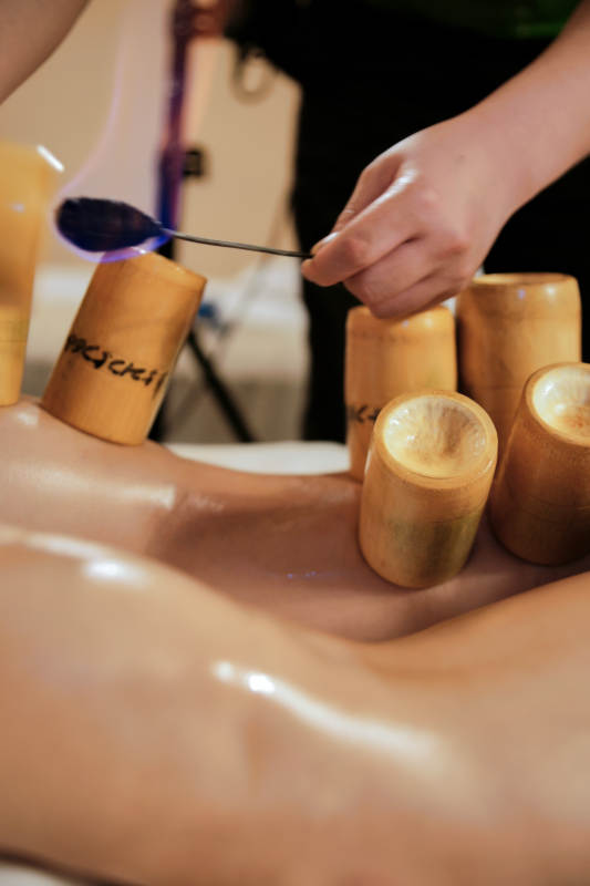 专业的保健技师为顾客进行吸筒疗法拔火罐图片