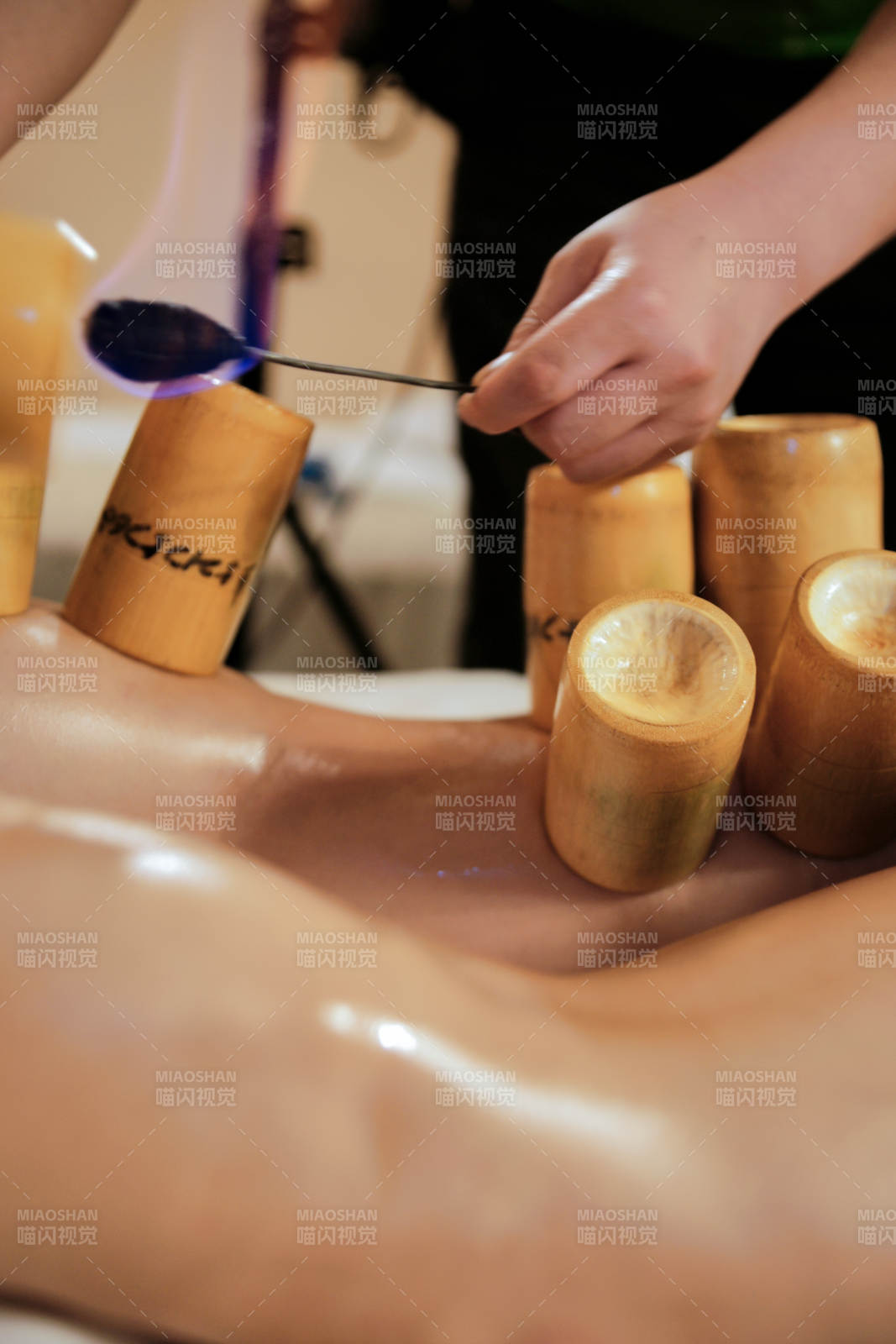 专业的保健技师为顾客进行吸筒疗法拔火罐图片