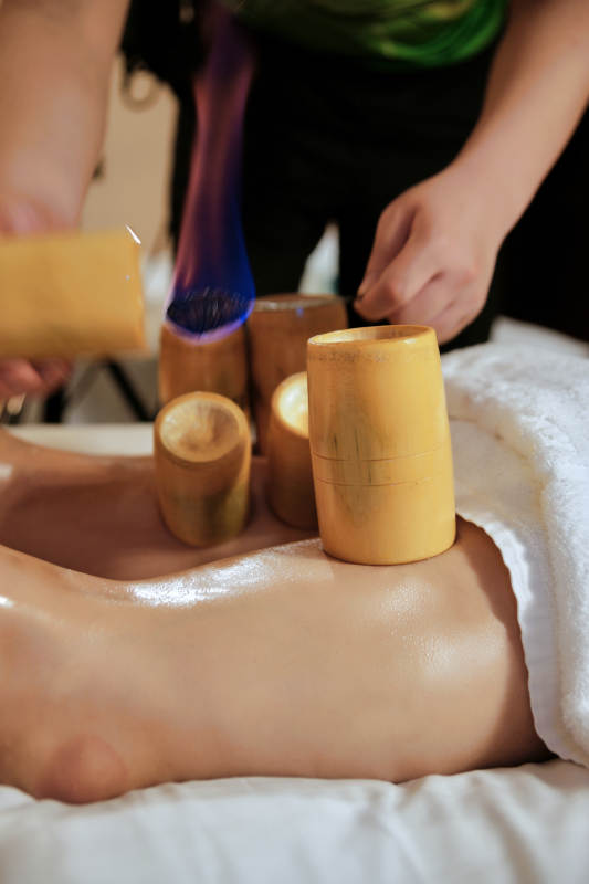 专业的保健技师为顾客进行吸筒疗法拔火罐图片