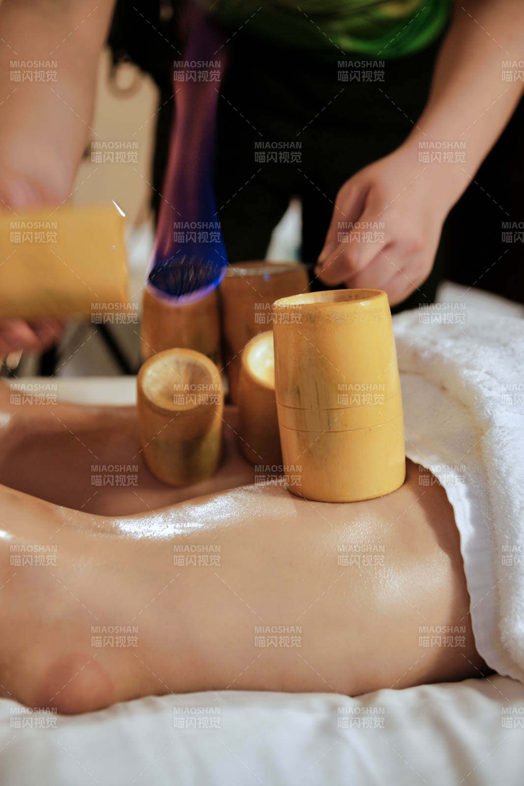 专业的保健技师为顾客进行吸筒疗法拔火罐图片