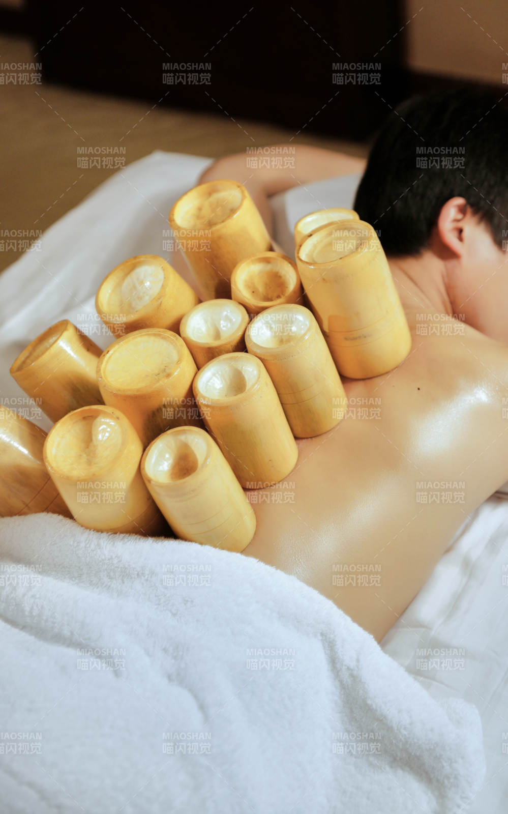 专业的保健技师为顾客进行吸筒疗法拔火罐图片