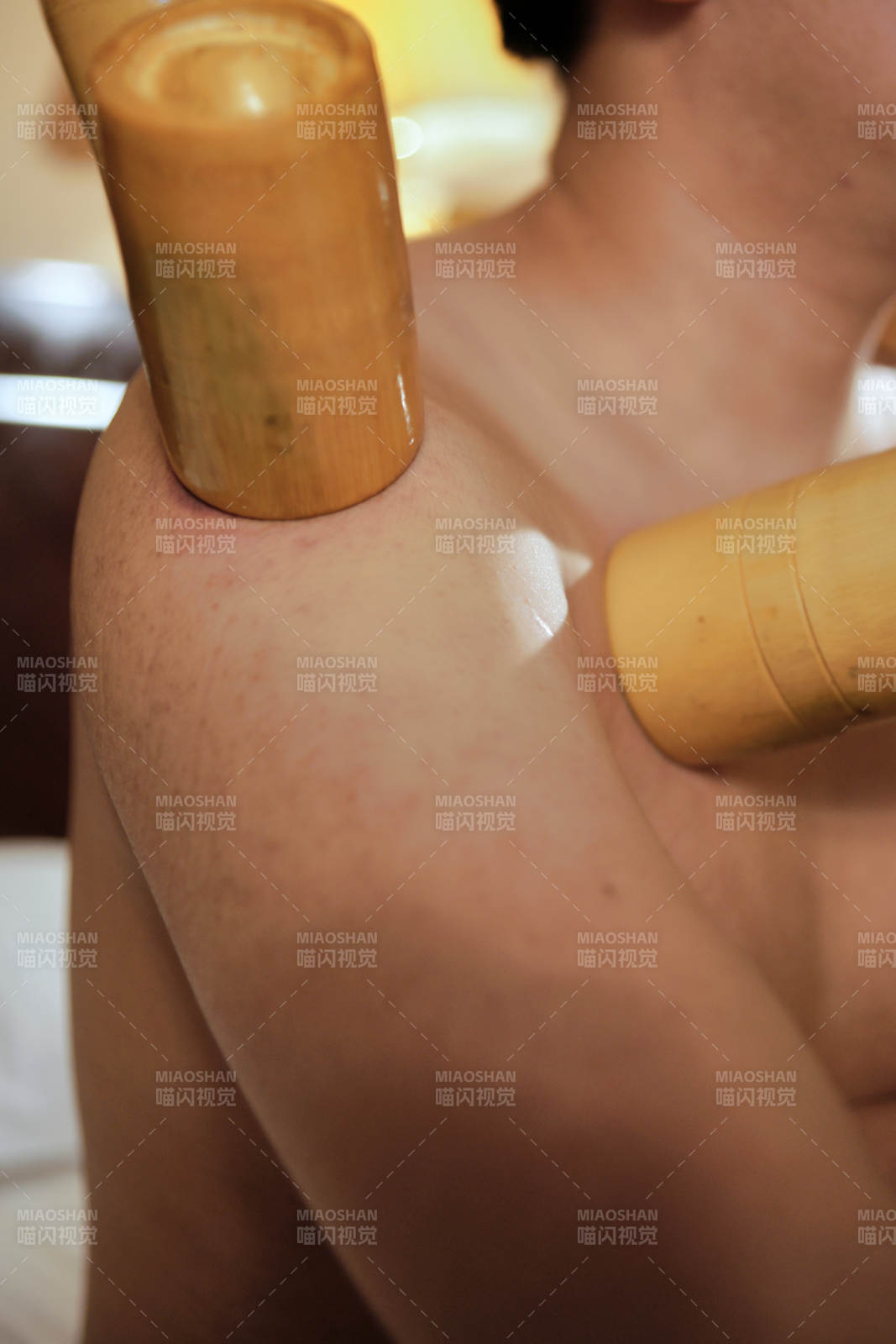 专业的保健技师为顾客进行吸筒疗法拔火罐图片