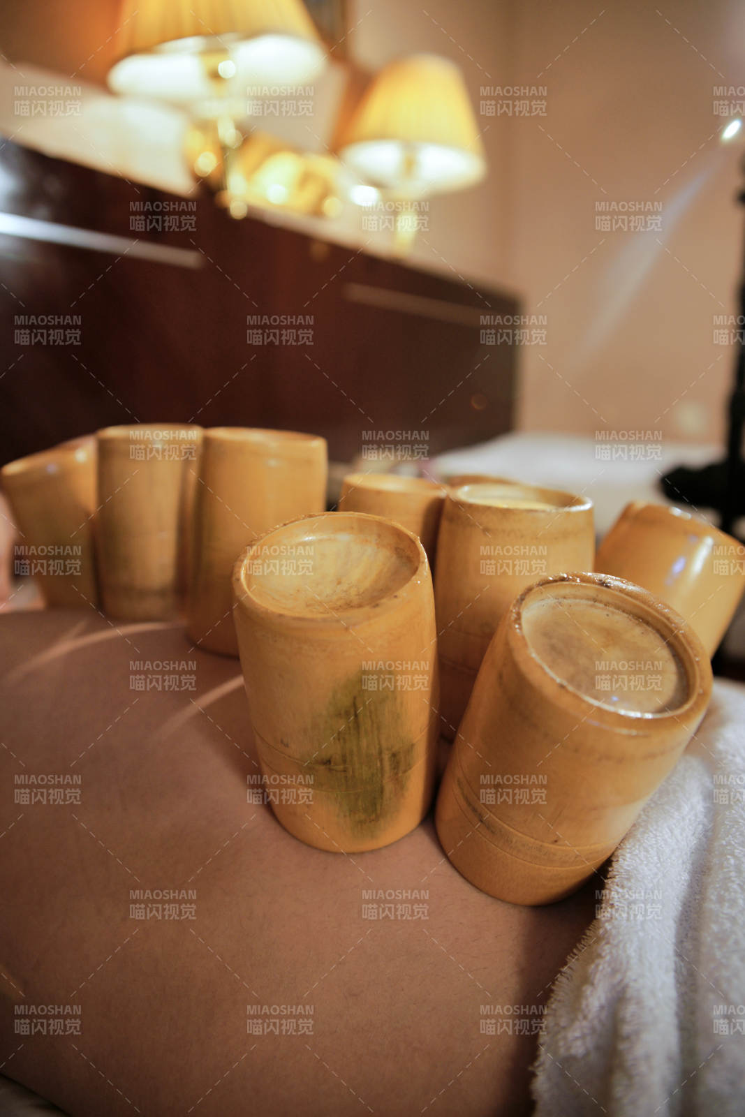 专业的保健技师为顾客进行吸筒疗法拔火罐图片