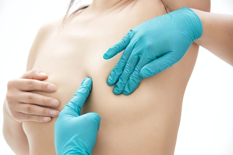 医生为胸部整形患者进行胸部检查图片