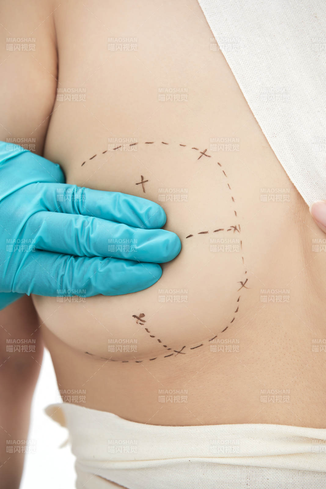 医生为胸部整形患者进行胸部检查图片