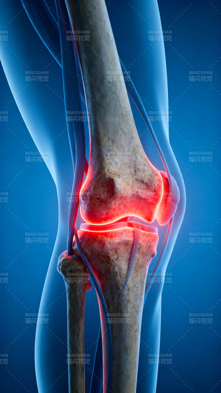膝关节炎症示意图图片