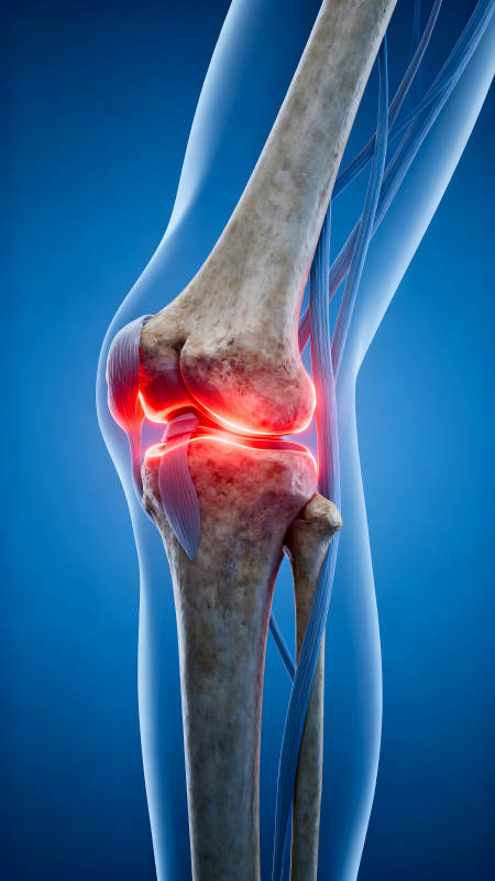 膝关节结构图示疼痛部位发红图片