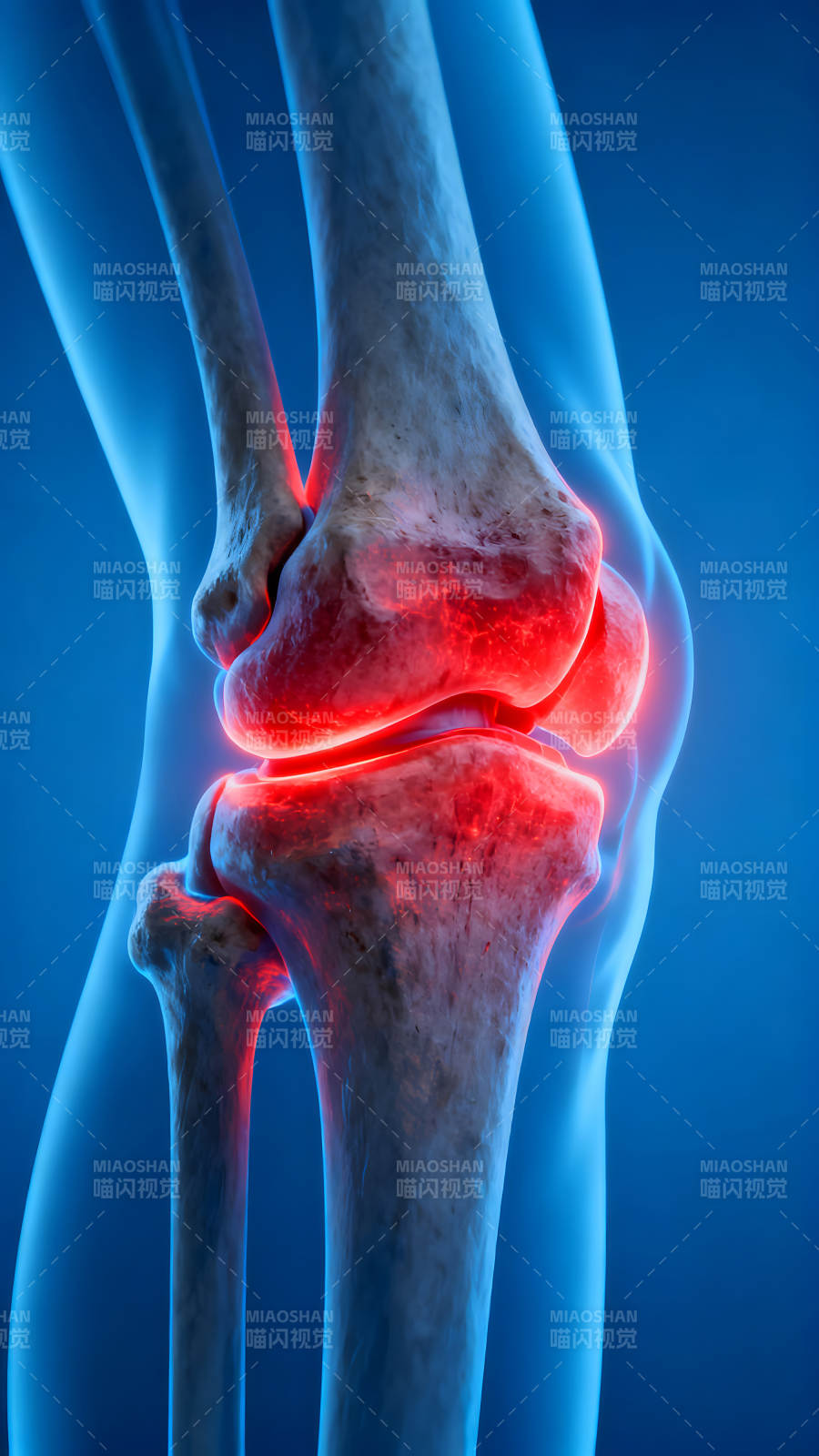 膝盖关节炎症图片图片
